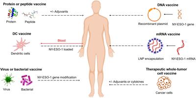 Current advances in cancer vaccines targeting NY-ESO-1 for solid cancer treatment